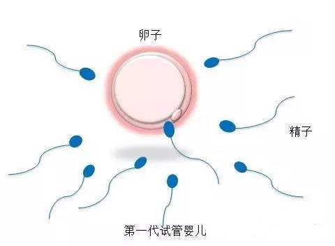 单身同志供卵公司